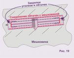 боковые закрепки
