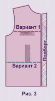 Варианты укрепления кармана