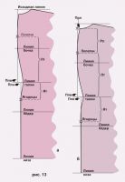 варианты среднего шва